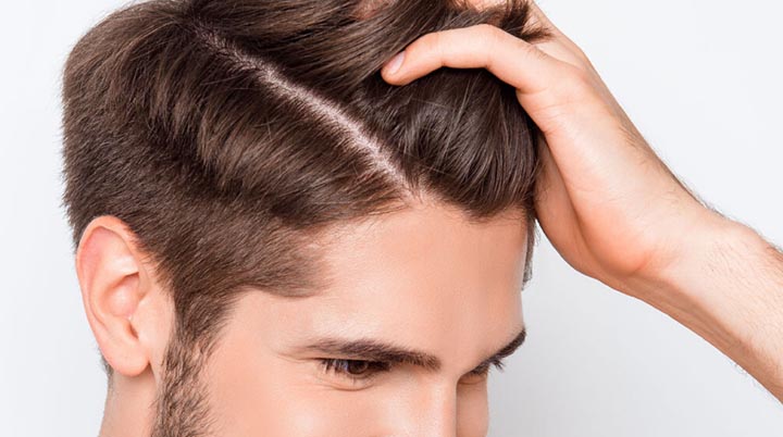 Top 15 Meilleur Effluvium Cheveux Restaurer Efficacement Les Cheveux Abîmés 50 Meilleur Effluvium Cheveux
